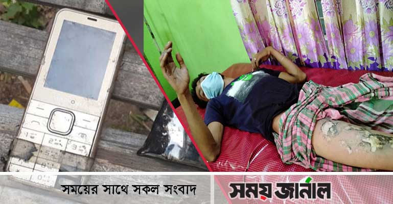 পকেটে মোবাইল বিস্ফোরণ, যুবক দগ্ধ