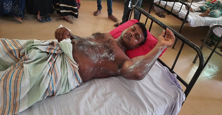 হিলিতে ঘুমন্ত যুবকের ওপর এসিড নিক্ষেপ