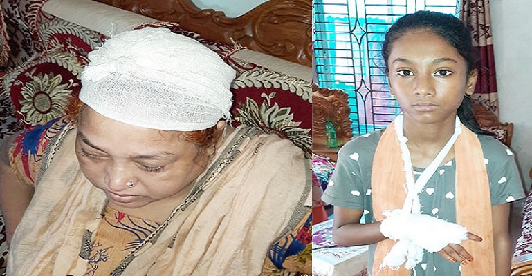 চৌদ্দগ্রামে প্রতিপক্ষের হামলায় ৪ নারী আহত