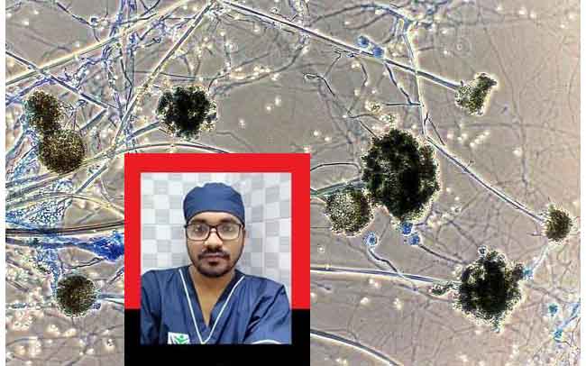 ব্ল্যাক ফাঙ্গাস কি? কিভাবে বাঁচবেন?