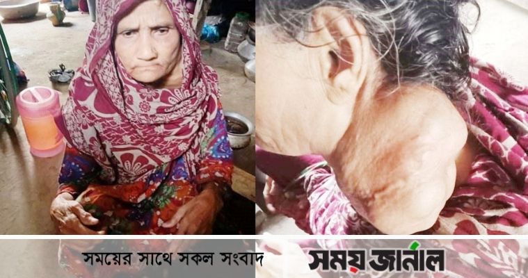 প্রায়ই না খেয়ে থাকতে হয় প্রতিবন্ধী সেনোয়ারাকে, সাহায্যের আবেদন