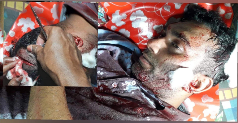 লক্ষ্মীপুরে হত্যা চেষ্টার মামলা করায় বাদিকে হুমকির অভিযোগ