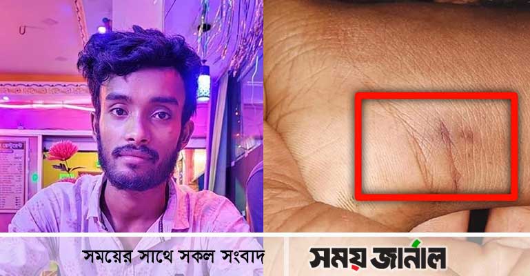 টুঙ্গিপাড়ায় সাপের কামড়ে কলেজ ছাত্রের মৃত্যু