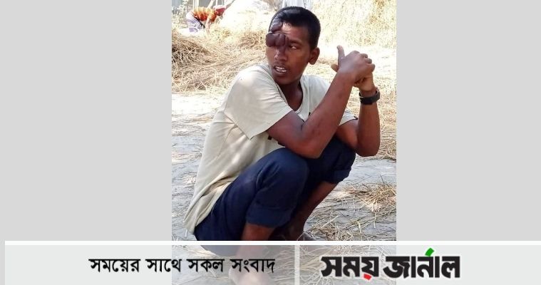 কুড়িগ্রামে মাকে বাঁচাতে গিয়ে প্রতিবন্ধী পুত্র খুন