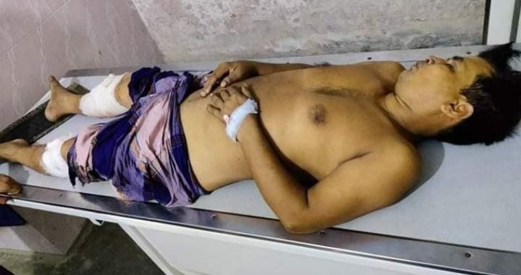 সালথায় ইউপি সদস্য ইমরুল খানের উপর বর্বরচিত হামলা