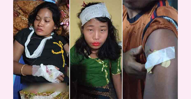 যাত্রীবাহী পিকআপ ভ্যানে সন্ত্রাসীদের গুলি, আহত ৩