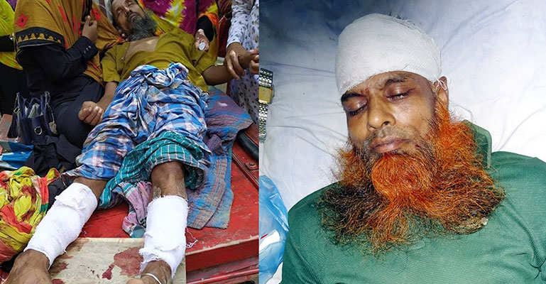 মোড়েলগঞ্জে দুর্বৃত্তদের হামলায় ইউপি মেম্বার প্রার্থী আহত