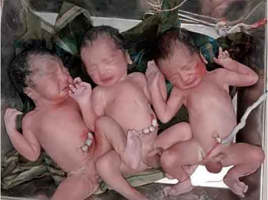 লালপুরে এক সঙ্গে ৩ শিশুর জন্ম