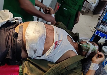 সিএনজি-রিকশা স্ট্যান্ড উচ্ছেদ করায় ২ আনসার সদস্যকে ছুরিকাঘাত