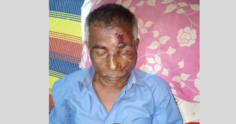 মোরেলগঞ্জে গভীর রাতে ব্যবসায়ীকে কুপিয়ে টাকা ও স্বর্ণালঙ্কার লুট