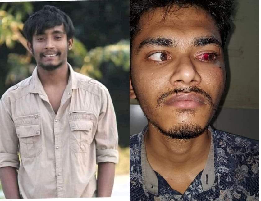 'তুমি' বলে সম্বোধন করায় শিক্ষার্থীকে পেটালো ছাত্রলীগ নেতা