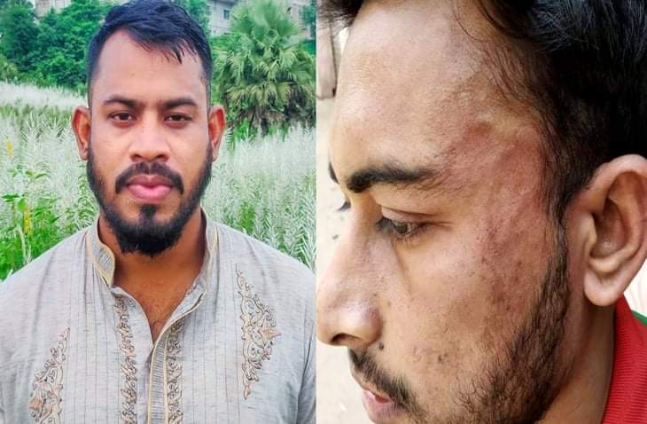 কুবিতে এবার শিক্ষার্থীকে পেটালো সাংবাদিক নেতা