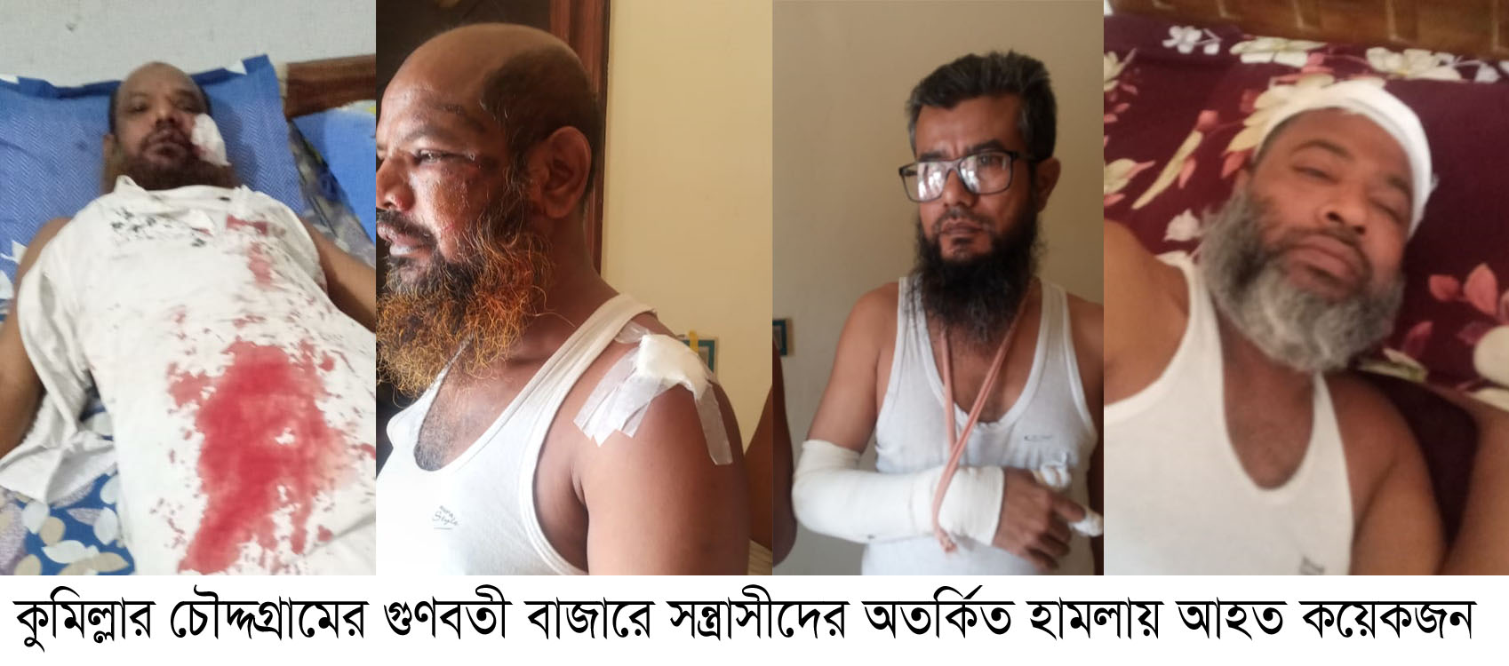চৌদ্দগ্রামে মার্কেটে ঢুকে সন্ত্রাসীদের অতর্কিত হামলায় আহত ৪
