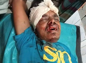 লালপুরে সড়ক দুর্ঘটনায় সাইকেল আরোহী নিহত, আহত ২