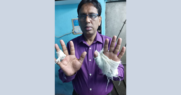 প্রকাশ্যে শিক্ষা কর্মকর্তাকে হাতুড়িপেটা করল চাঁদাবাজি মামলার আসামিরা