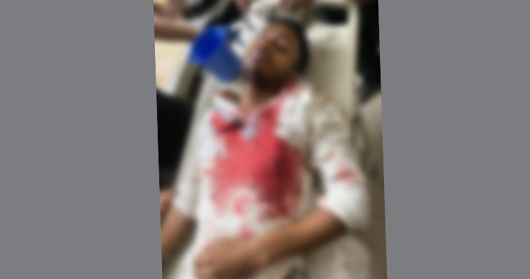 নোয়াখালীতে ছাত্রদল কর্মীকে কুপিয়ে রাস্তার পাশে ফেলে গেল দুর্বৃত্তরা