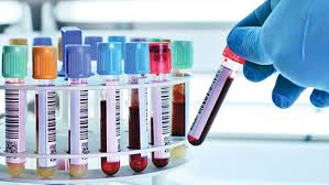 কোন রোগের জন্য কি টেষ্ট করা হয়: