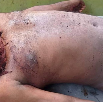 লালপুরে বাবার হাসুয়ার কোপে ছেলে নিহত