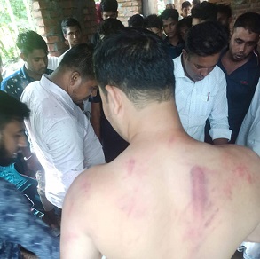 নোয়াখালীতে কেন্দ্রীয় ছাত্রদল নেতার ওপর হামলা