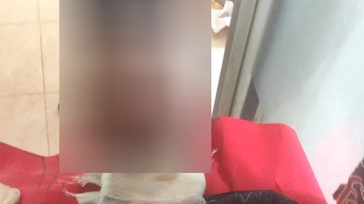 প্রেমে সাড়া না পেয়ে নিজের গলায় ছুরি চালালো কিশোর