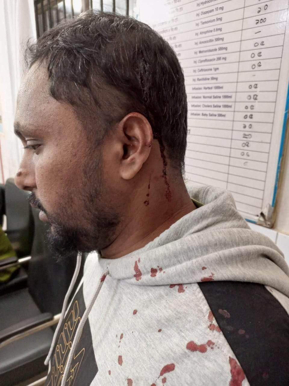 আশুলিয়ায় যুবককে ডেকে নিয়ে মারধরের অভিযোগ বাবা-ছেলের