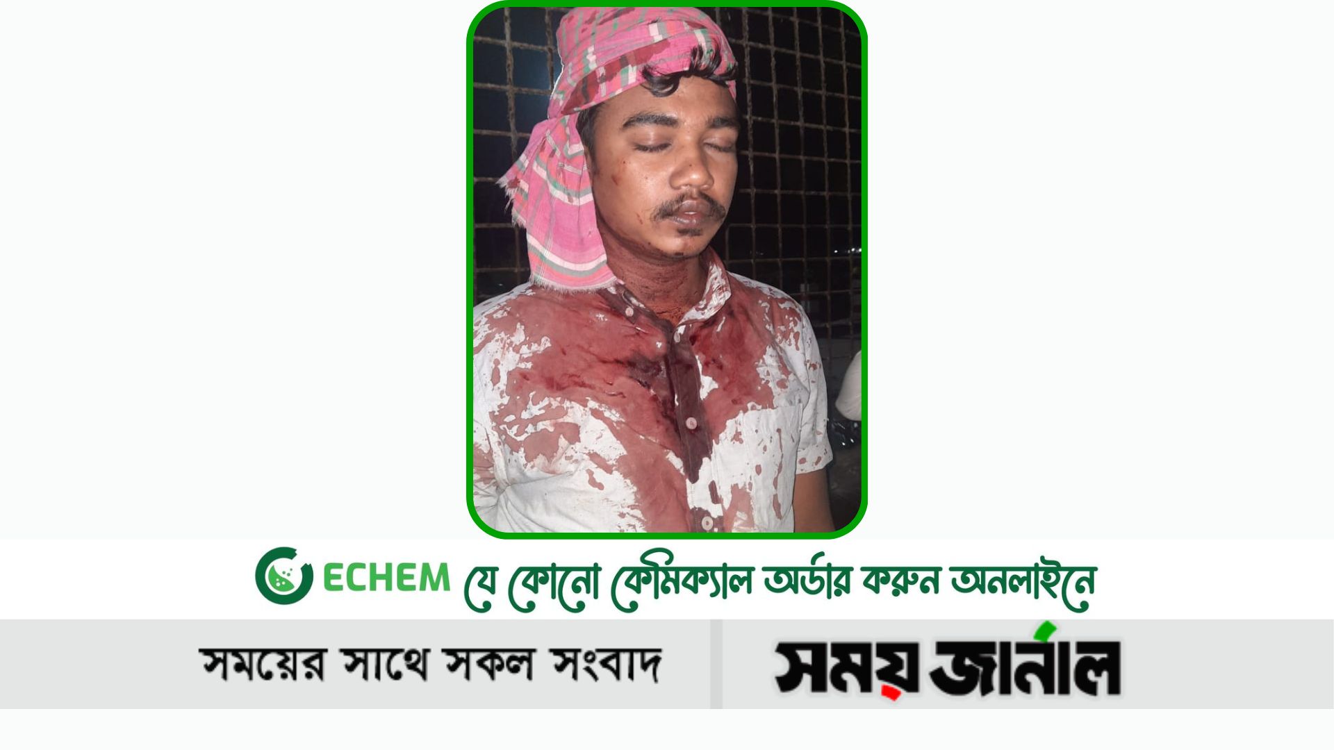 চেয়ারম্যানের ভাগ্নের নেতৃত্বে সাবেক ছাত্রলীগ নেতাকে কুপিয়ে জখম, অবস্থা আশঙ্কাজনক