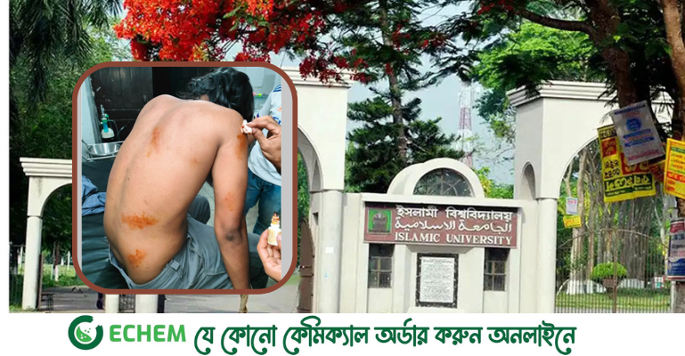 প্রতিশোধ নিতে বহিরাগতদের দ্বারা ইবি শিক্ষার্থীকে মারধর