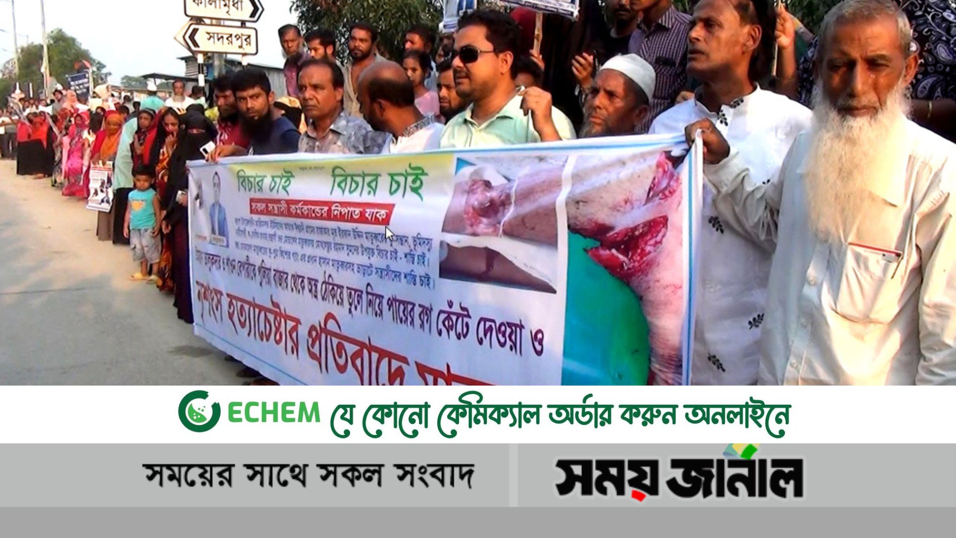 ফরিদপুরে অস্ত্রের মুখে তুলে নিয়ে পায়ের রগ কেটে  হত্যা চেষ্টার প্রতিবাদে মানববন্ধন ও বিক্ষোভ