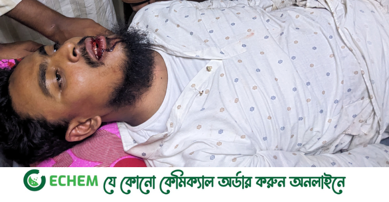 গণতান্ত্রিক ছাত্রশক্তির আহ্বায়ক আখতারের উপর হামলা
