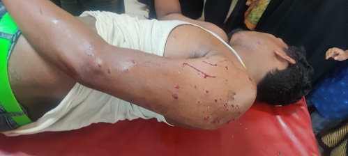 নোয়াখালীতে ইয়াবা সেবন নিয়ে বিরোধ, অটোরিকশা চালক গুলিবিদ্ধ