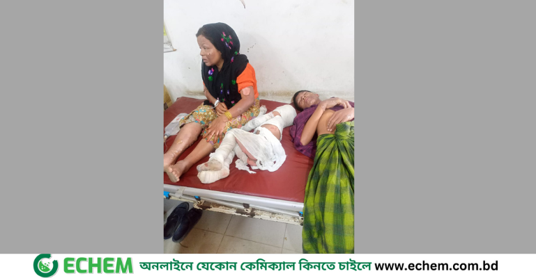 ভাসানচরে রোহিঙ্গা ক্যাম্পে গ্যাস সিলিন্ডার বিস্ফোরণ, ৫শিশুসহ ৯জন দগ্ধ
