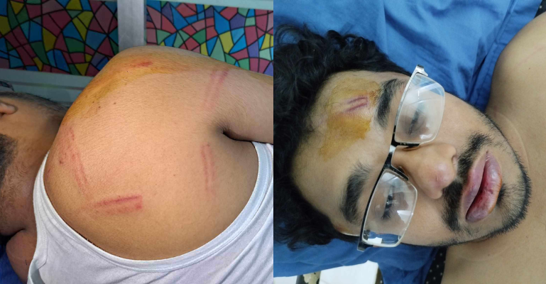 তিতুমীর কলেজ ছাত্রলীগের হামলায় গুরুতর আহত সাংবাদিক সাব্বির আহমেদ