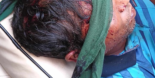 ফরিদপুরে কৃষককে কুপিয়ে  পেঁয়াজ ছিনতাই