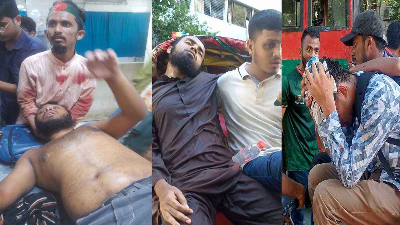 ছাত্রলীগের হামলায় দেড় শতাধিক শিক্ষার্থী আহত, আন্দোলন অব্যাহত থাকবে