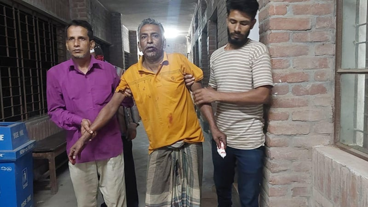 জাহাঙ্গীরনগর বিশ্ববিদ্যালয়ে শিয়ালের কামড়ে শিক্ষার্থীসহ আহত ৩