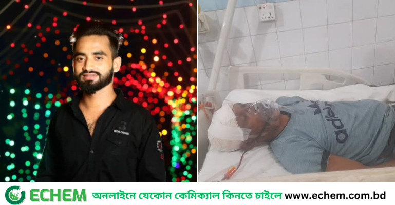 মেয়েকে ইভটিজিংয়ের প্রতিবাদ করায় বাবাকে কুপিয়ে জখম