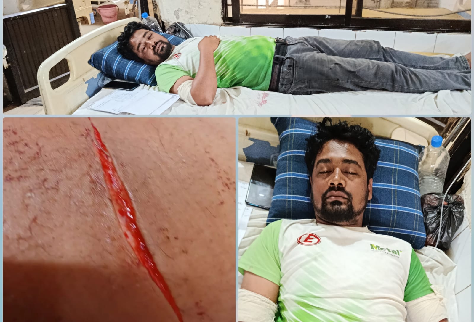 সুবর্ণচরে চাঁদাবাজীর মামলা করায় যুবককে কুপিয়ে আহত করার অভিযোগ