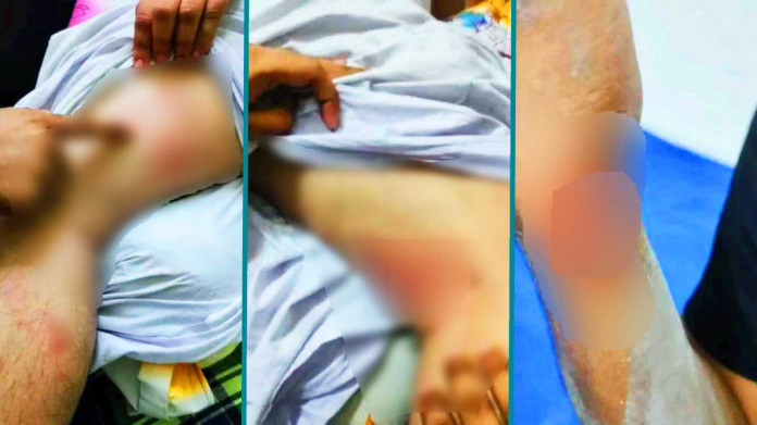 আন্দোলনে নেতৃত্ব দেওয়া চার কুয়েট শিক্ষার্থীর ওপর হামলা