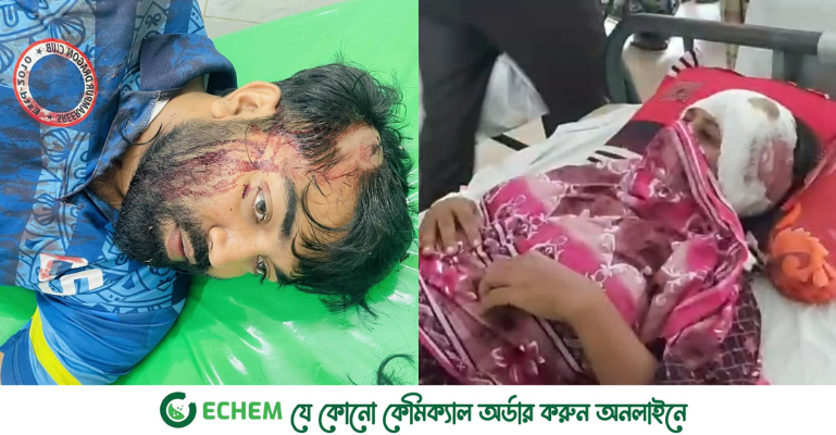 বড়াইগ্রামে রাস্তা নিয়ে সংঘর্ষে এনসিপি নেতাসহ আহত ৫