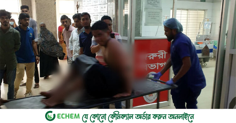 শিক্ষার্থীসহ ২০ জন বার্ন ইনস্টিটিউটে ভর্তি