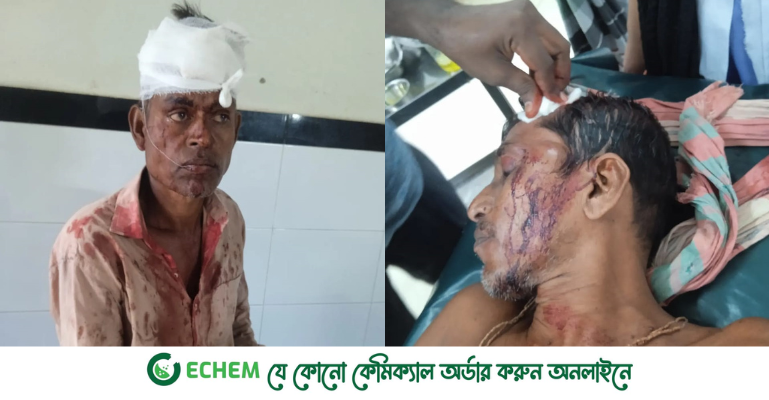 ফরিদপুরে বাঁশ টাঙানোকে কেন্দ্র দুইপক্ষের সংঘর্ষ, নারীসহ আহত ২০ জন