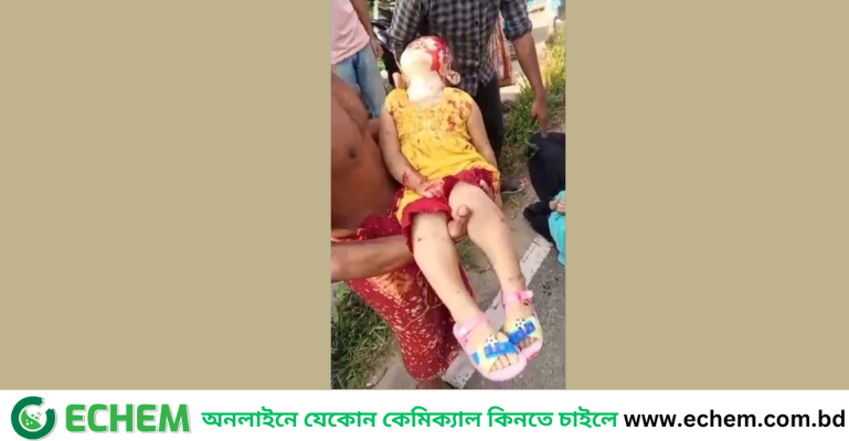 নোয়াখালীতে সিএনজি নিয়ন্ত্রণ হারিয়ে আইল্যান্ডে ধাক্কা, শিশু নিহত