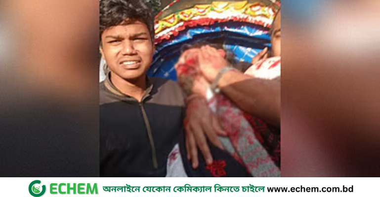 হাদি ছিলেন রিকশায়, মোটরসাইকেলে এসে দুর্বৃত্তরা গুলি করে