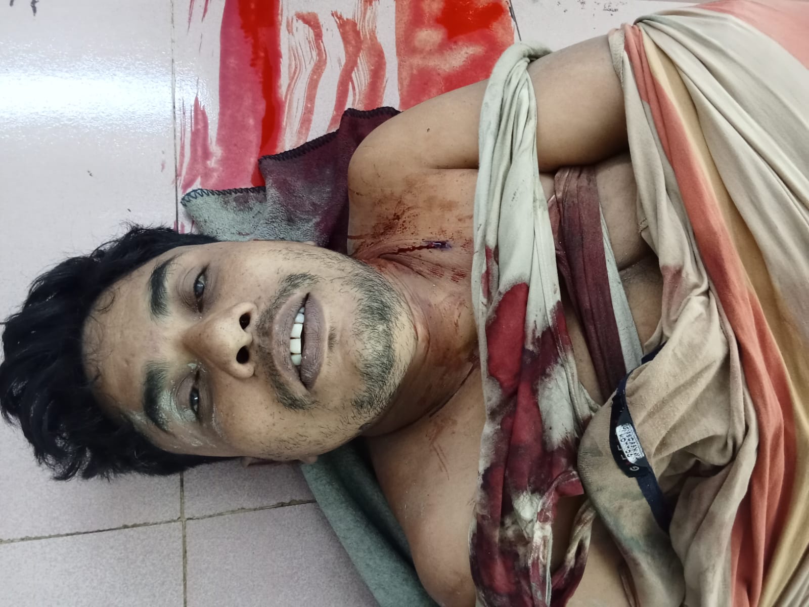 নোয়াখালীতে চর দখল নিয়ে গোলাগুলি, নিহত ৫