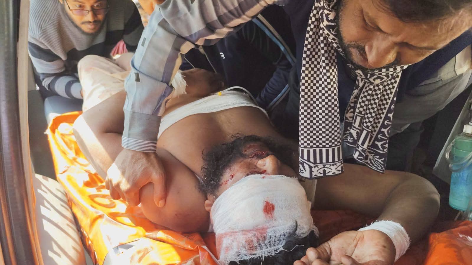 বড়াইগ্রামে নির্বাচন পরবর্তী সহিংসতায় জামায়াত-বিএনপি ৭জন আহত