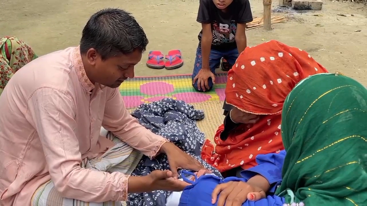 নাটোরে হামে আক্রান্ত ৩৮: দুশ্চিন্তায় স্বজনেরা, রামেক হাসপাতালে চিকিৎসাধীন অবস্থায় মারা গেছে এক শিশু