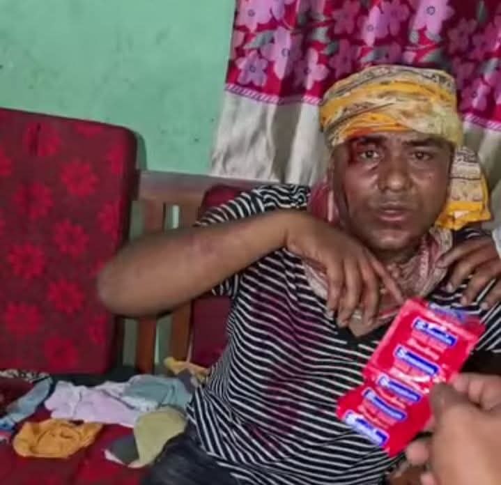 ফরিদপুরের সালথায় পরকীয়ার অভিযোগে এএসআইকে গণপিটুনি