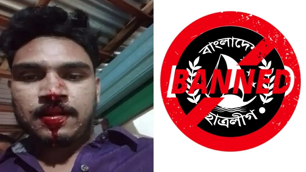 নিষিদ্ধ ছাত্রলীগের হামলায় আহত ডিআইইউ ছাত্র নেতা